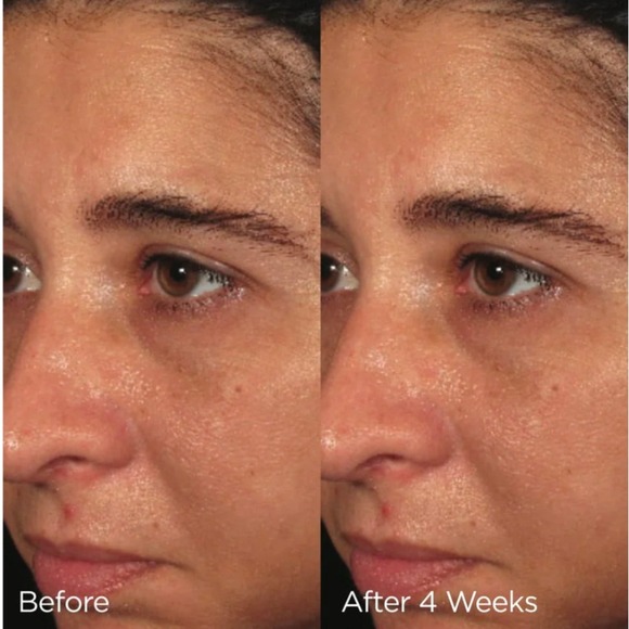 IMAGE Skincare ORMEDIC Balancing Bio-Peptide Creme 2oz 57g Moisturizer - Picture 5 of 6